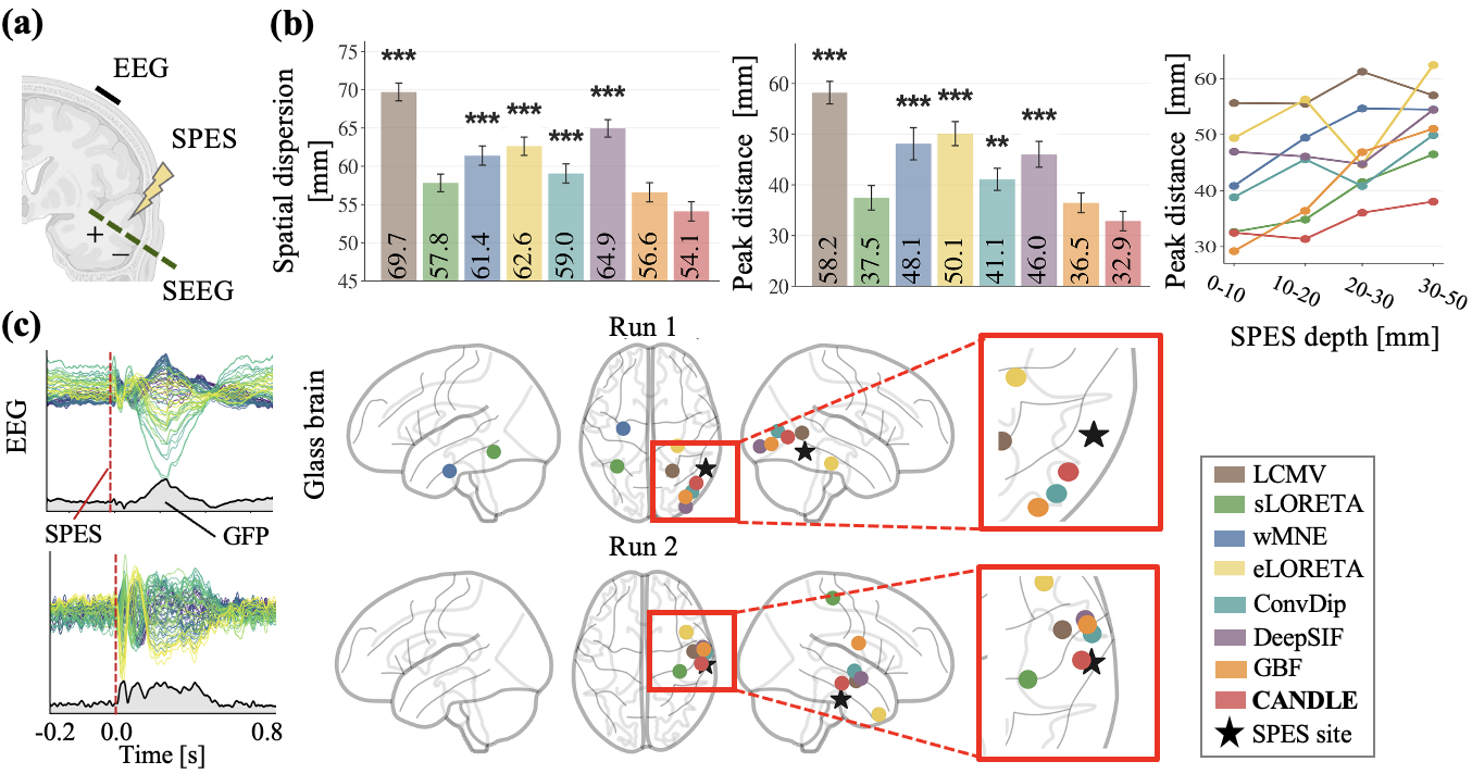 Results for intracranial stimulation localization